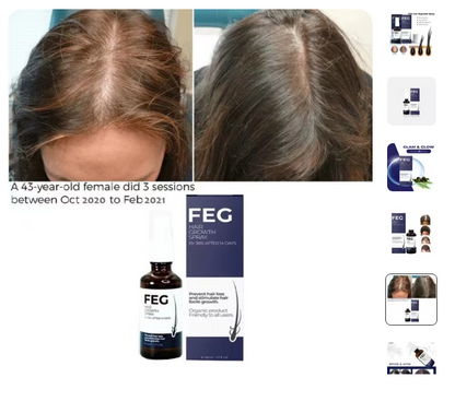 FEG: Hair Growth Spray